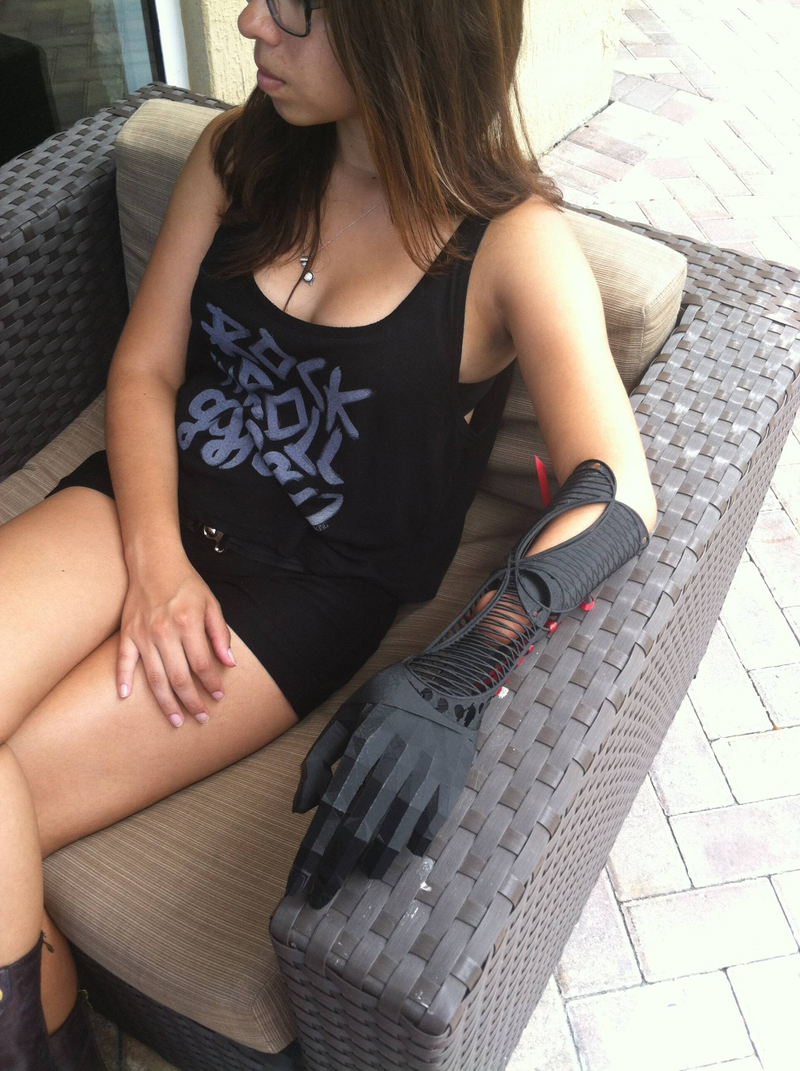 Illustration for article titled Stylish 3D-Printed Prosthetic Arm